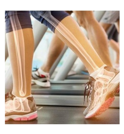 Osteoporose e outras Doenças ÓsseasPrevenção e tratamento da perda de massa óssea, fraturas e distúrbios metabólicos ósseos, promovendo saúde e fortalecimento dos ossos.